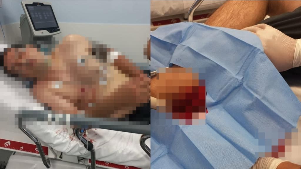 Homem sofre facada na perna e no peito após tentativa de homicídio, em Itapema