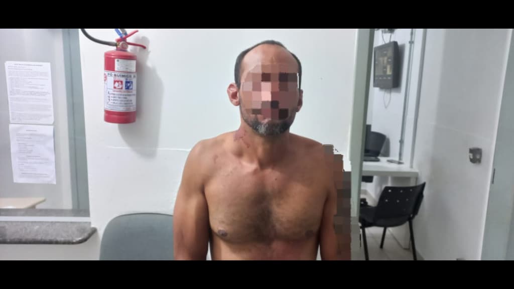 Homem agride ex-mulher com socos e avança contra PM em Tijucas