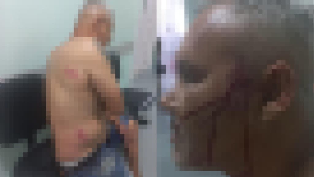 Inquilino atrasa o aluguel e acaba espancado, em Itapema