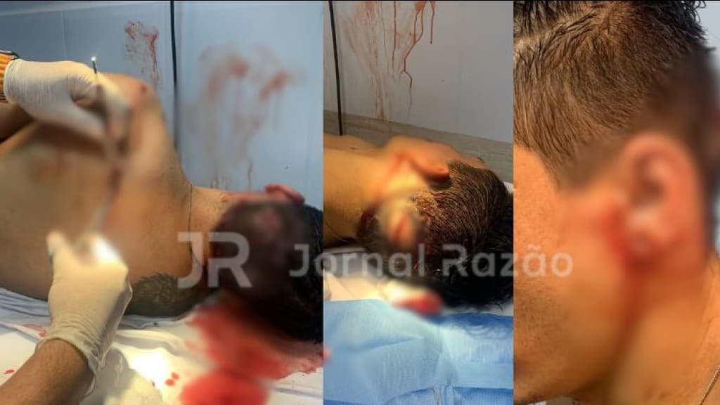 Ladrões tentam matar ciclista em Itapema para roubar bicicleta