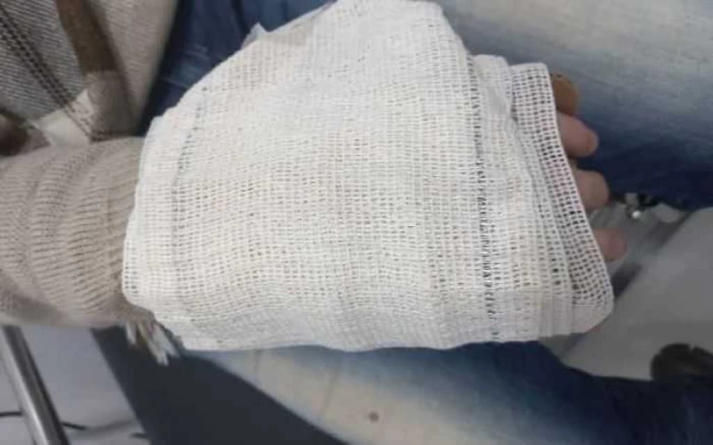Aluno que espancou professor com vassouradas em SC é internado