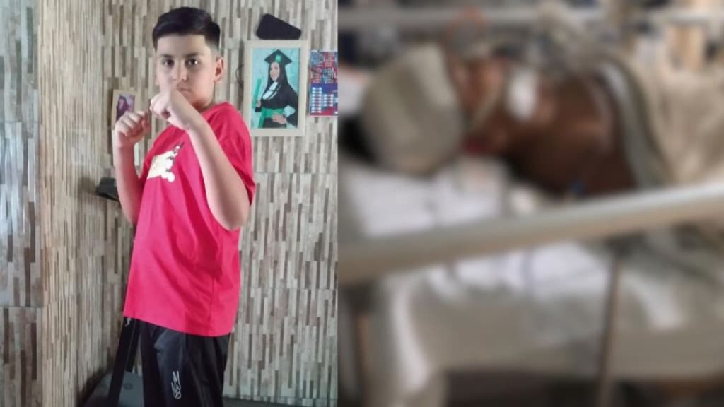 Família de Tijucas pede ajuda para menino de 10 anos vítima de acidente