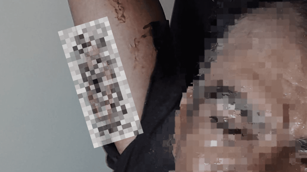 Homem tenta matar namorado de sua ex-esposa, em Itapema