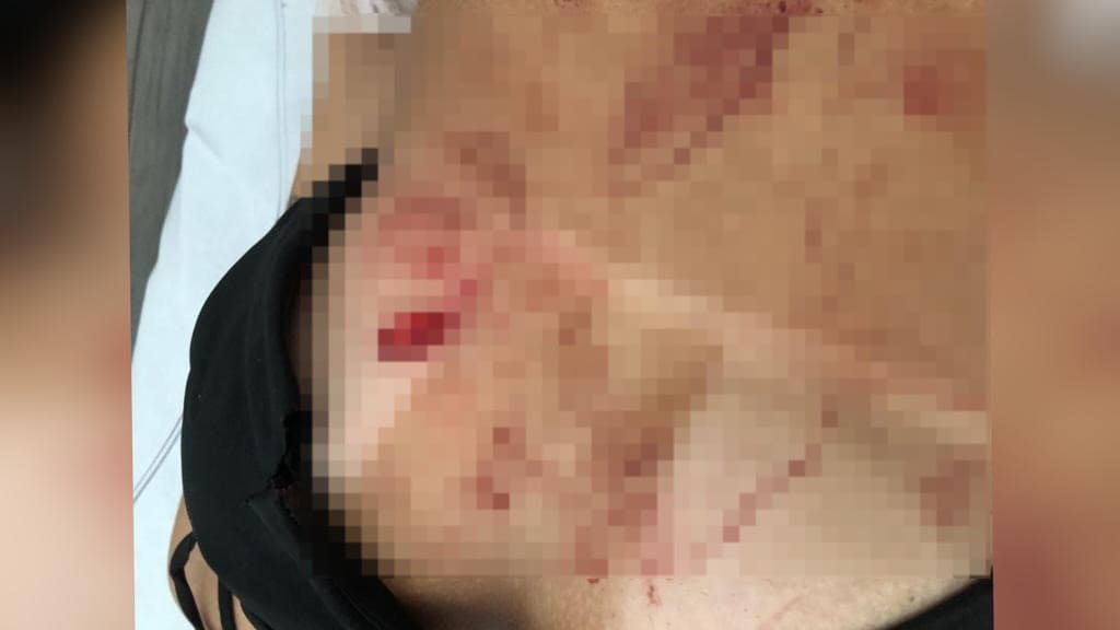 Jovem trans leva garfada no peito durante festa em Itapema