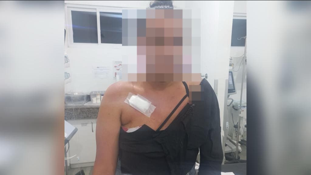 Transexual é assaltada e esfaqueada á caminho do trabalho, em São João Batista