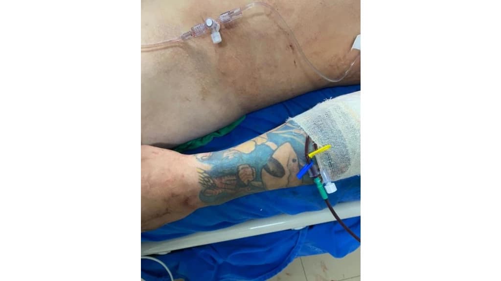 Homem é encontrado baleado as margens da BR101 e morre no hospital em Itajaí