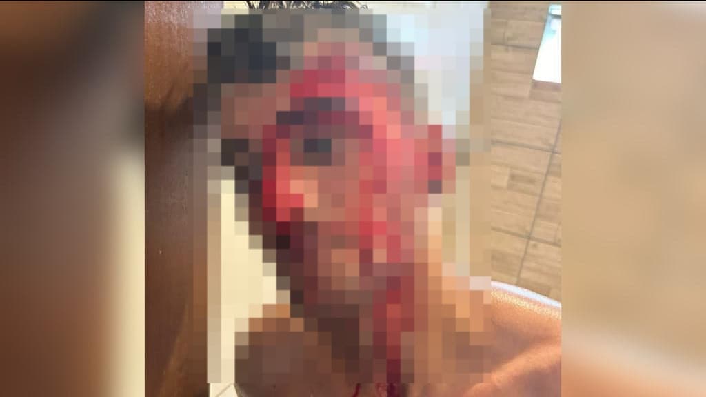 Mulher espanca amigo do irmão, em Camboriú: “folgado”
