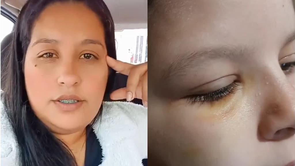Mãe chama a PM após filha de 9 anos ser espancada por colega de escola