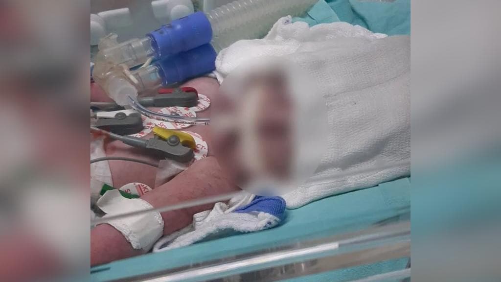 Pais são indiciados por morte de bebê pisoteado em SC: “cabeça estourada”