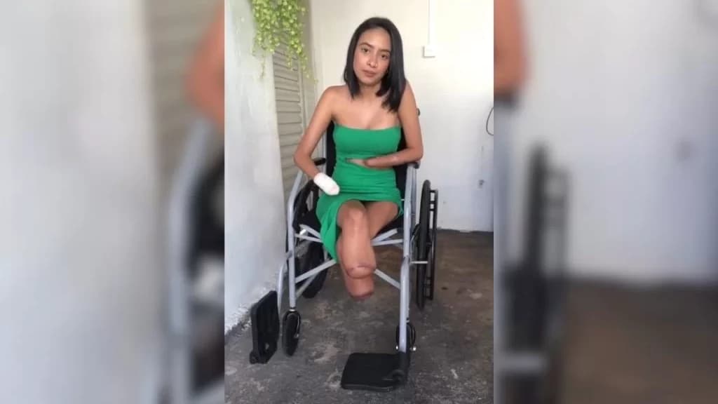 Jovem de 20 anos tem pés e mãos amputados após infecção urinária