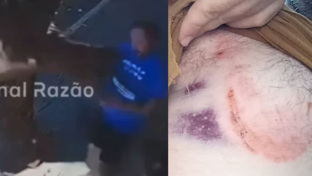 VÍDEO: Burro morde vereador que caminhava por rua no Paraná