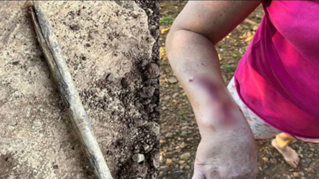 Mulher é espancada por marido mas pede para PM não prendê-lo