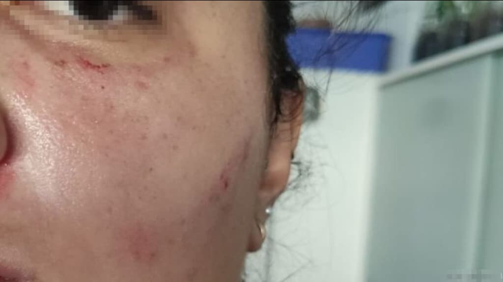 Mulher é espancada por atual companheira do ex-marido