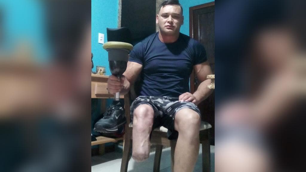 Morador de Tijucas precisa de ajuda para trocar prótese