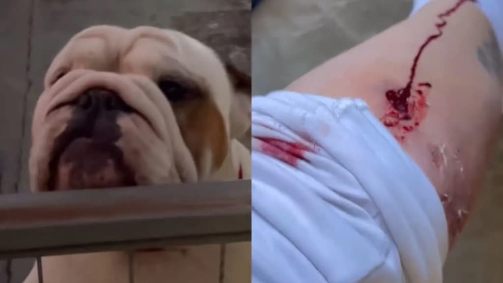 Catarinense é brutalmente atacada por seu próprio cão de estimação: “corre, Margarete”