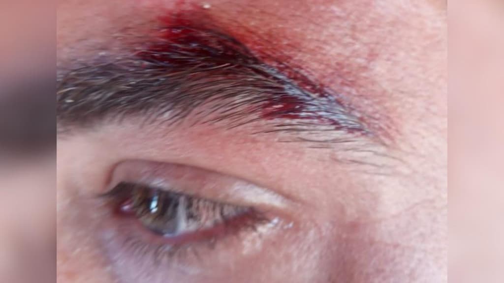 Violência na praia: Guarda-Vidas é agredido ao tentar socorrer vítima em Florianópolis