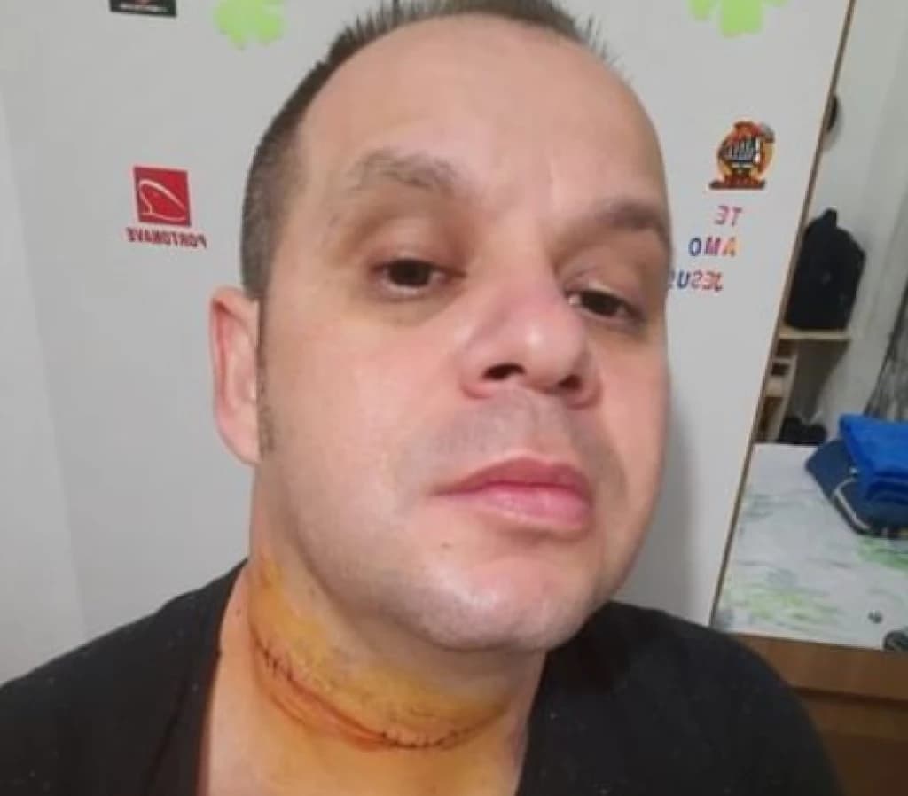Motociclista quase foi degolado por linha de cerol