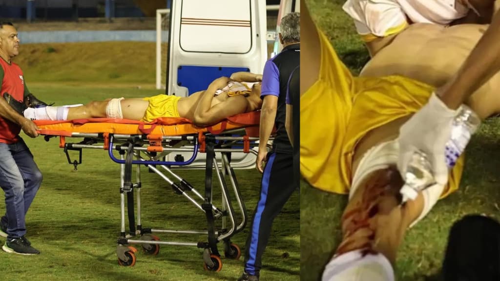 VÍDEO: Goleiro é baleado dentro de campo durante confusão pós-jogo
