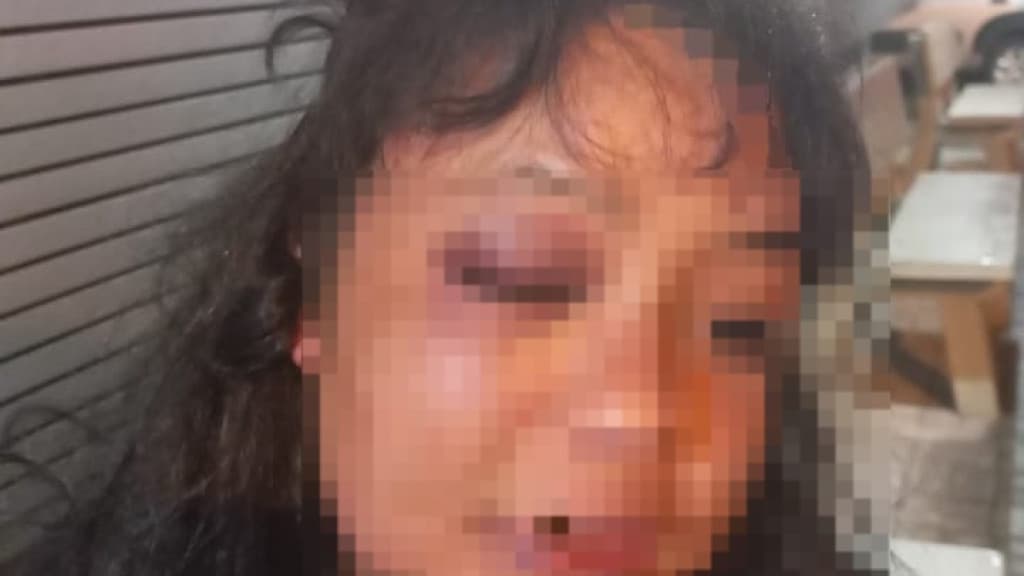Mulher cai na porrada com morador de rua em Itapema
