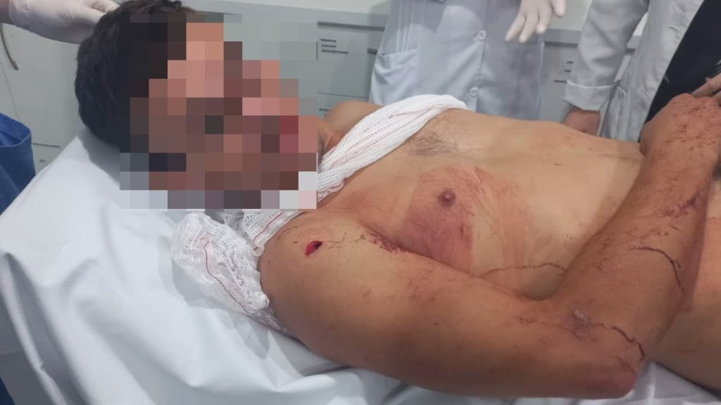 Homem é esfaqueado pela esposa mas recusa fazer B.O por amá-la demais