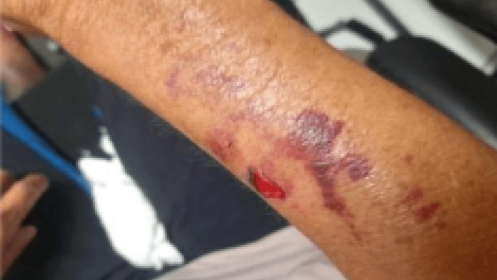 Mulher espanca mãe a pauladas em SC e acaba agredida por moradores
