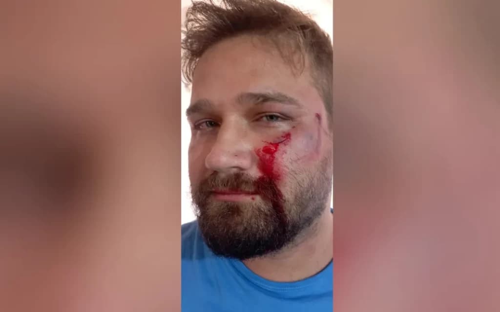 Pai de paciente agride médico após negar atestado ao filho