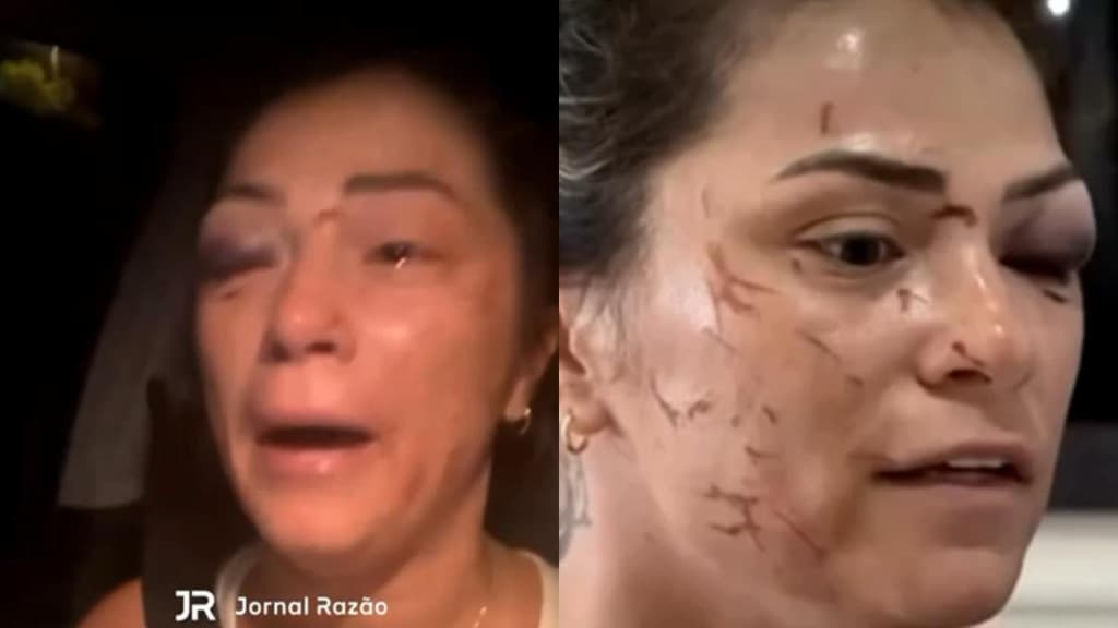 Reviravolta após polêmica em SC: mulher mentiu e não foi agredida pelo ex-marido