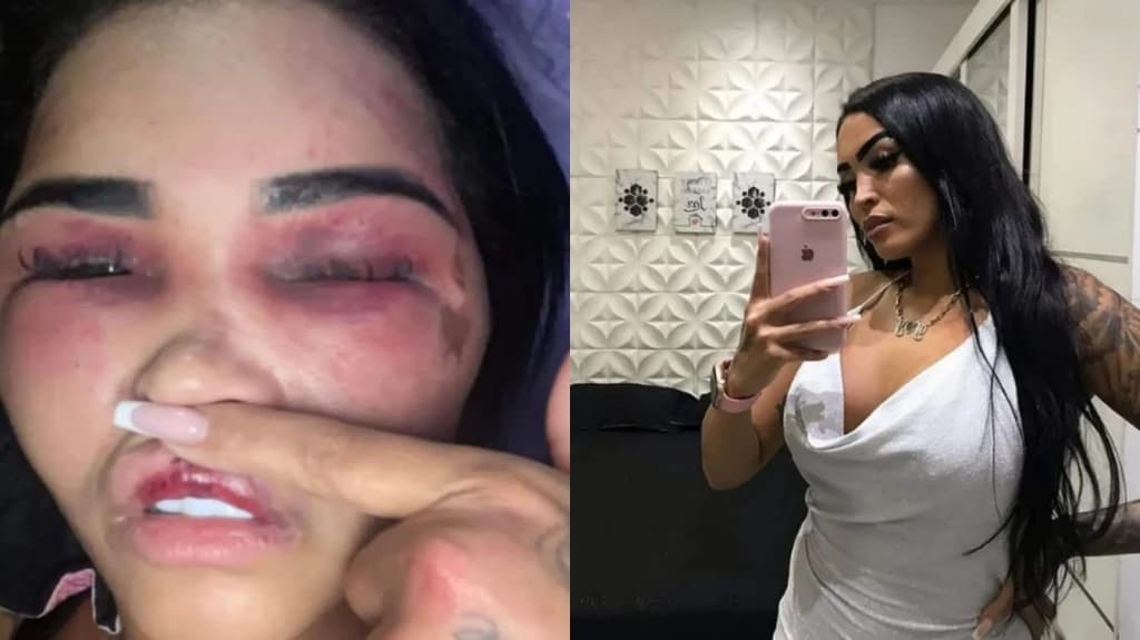 Ex-marido é acusado de espancar influenciadora digital