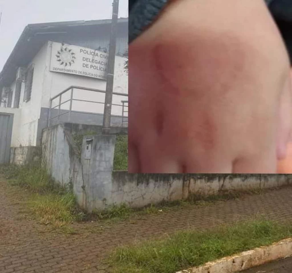 Diretora de escola morde aluno de 4 anos “para educar”