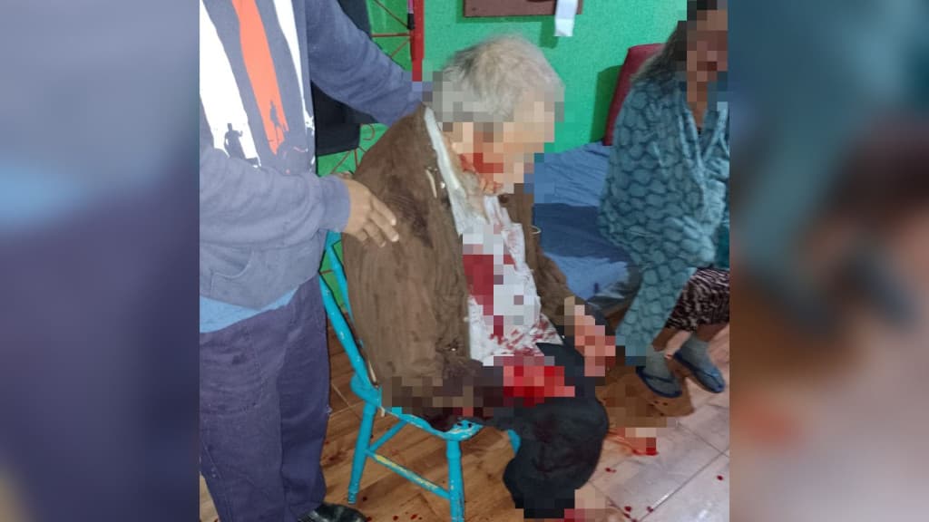 Casal de idosos é espancado até sangrar após ter casa invadida por criminosos em SC