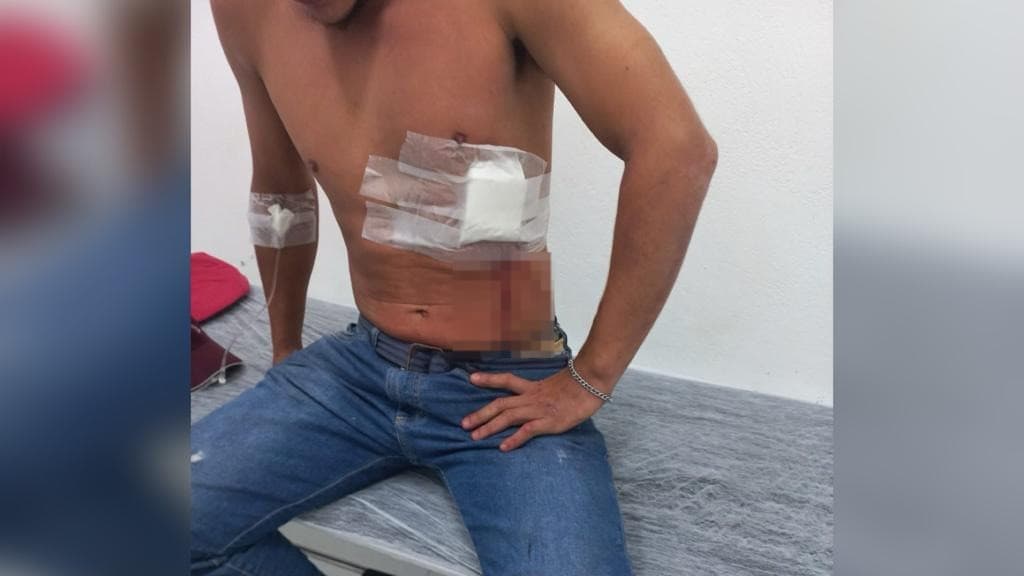 Homem finge pedir horário, vítima puxa celular e acaba esfaqueada no peito