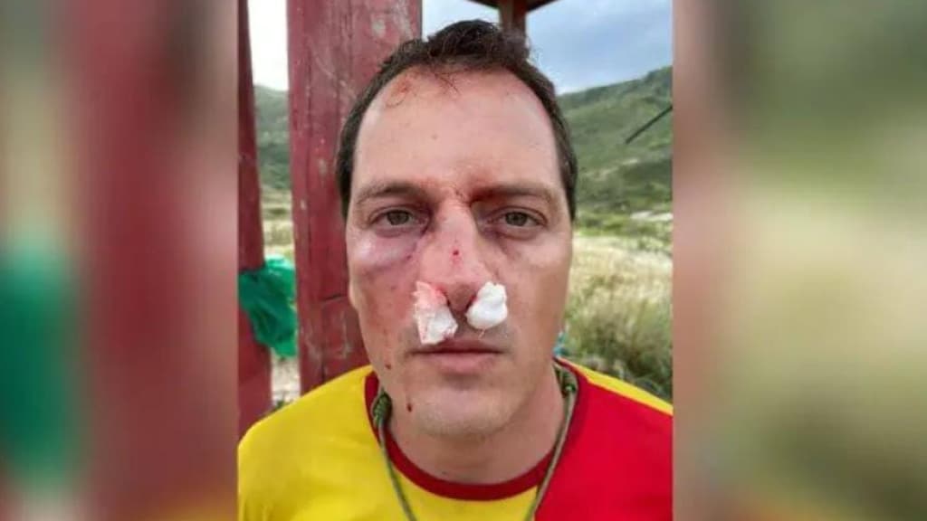 “Mijão” em praia de nudismo de Floripa acaba em briga com guarda-vidas