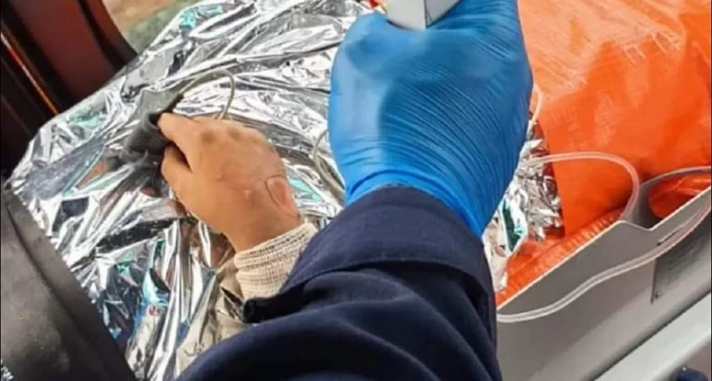 Crianças sofrem graves queimaduras ao tentar fazer pipoca em fogão a lenha