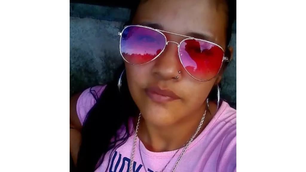 Após ficar em coma mulher acorda e acusa marido de tê-la queimado e morre