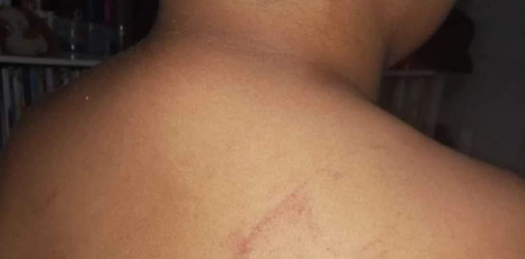 Mãe vai a justiça após filho de 4 anos sofrer agressão em escola