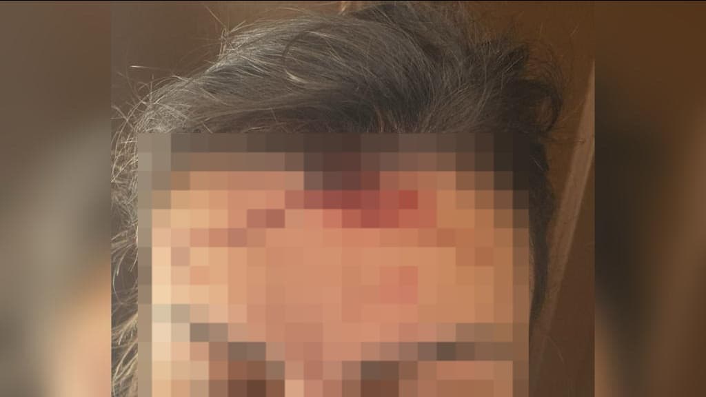 Homem agride mulher na cabeça durante discussão em Tijucas