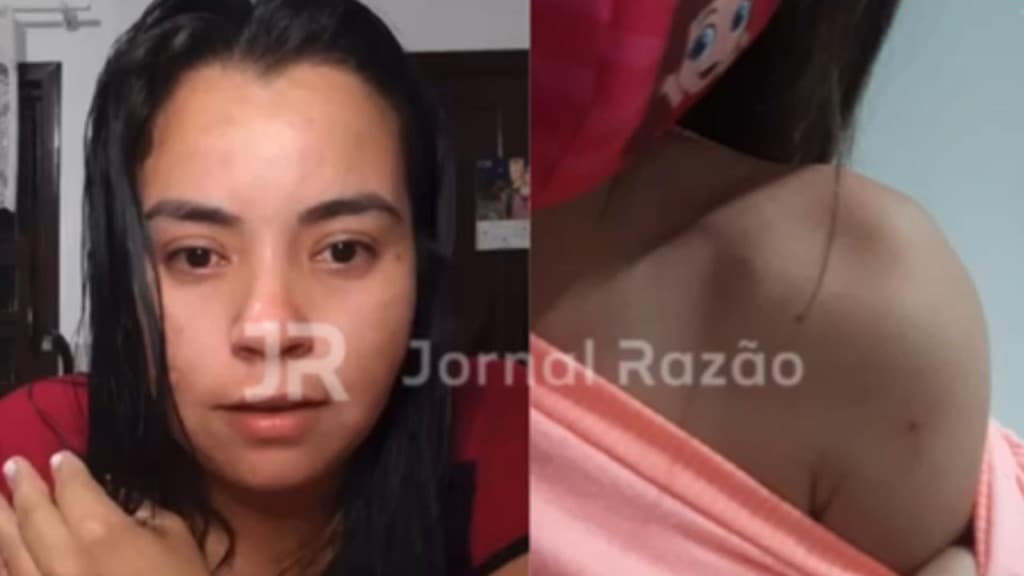 “Mãe, ela colocou a agulha em mim”: enfermeira “fura” criança com seringa de paciente com doença sexual