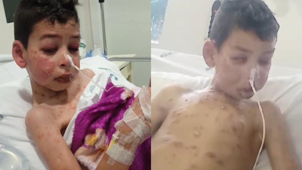 URGENTE: Menino de 7 anos com síndrome rara precisa de vaga em hospital de Florianópolis