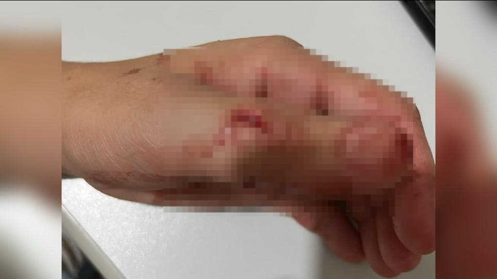 Mulher leva facada durante discussão com o companheiro, em Tijucas