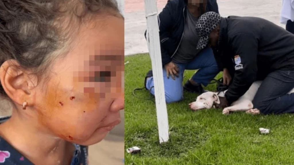 Dono de pit bull solto na rua é preso após o animal atacar pescoço de menina de 3 anos em SC