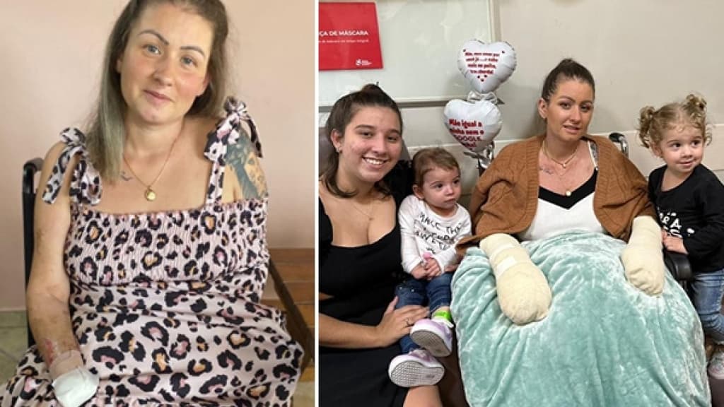 Guerreira busca ajuda para comprar próteses de mãos e pernas