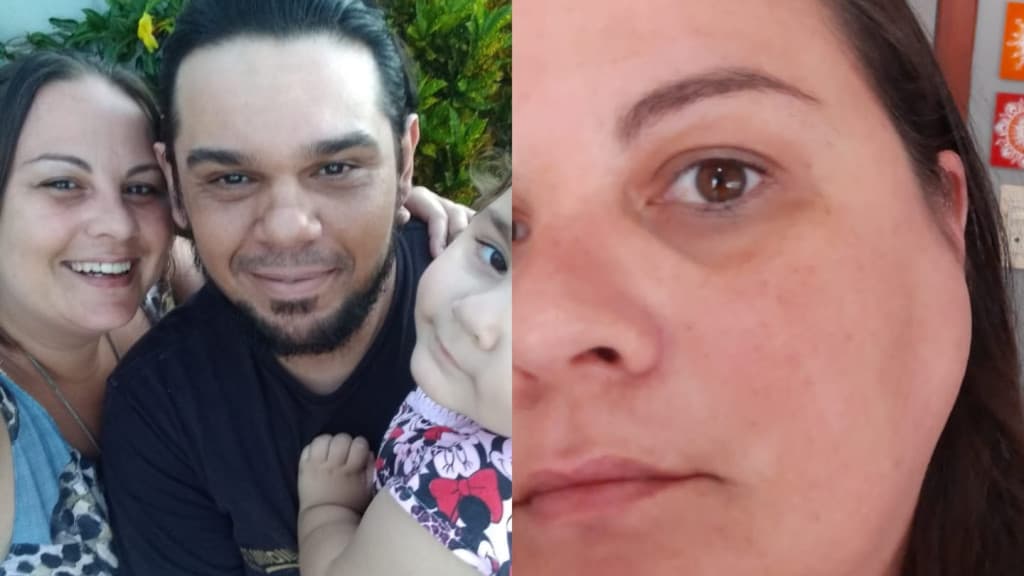 FINAL FELIZ: Moradora de Tijucas alcança valor após campanha solidária para cirurgia de tumor