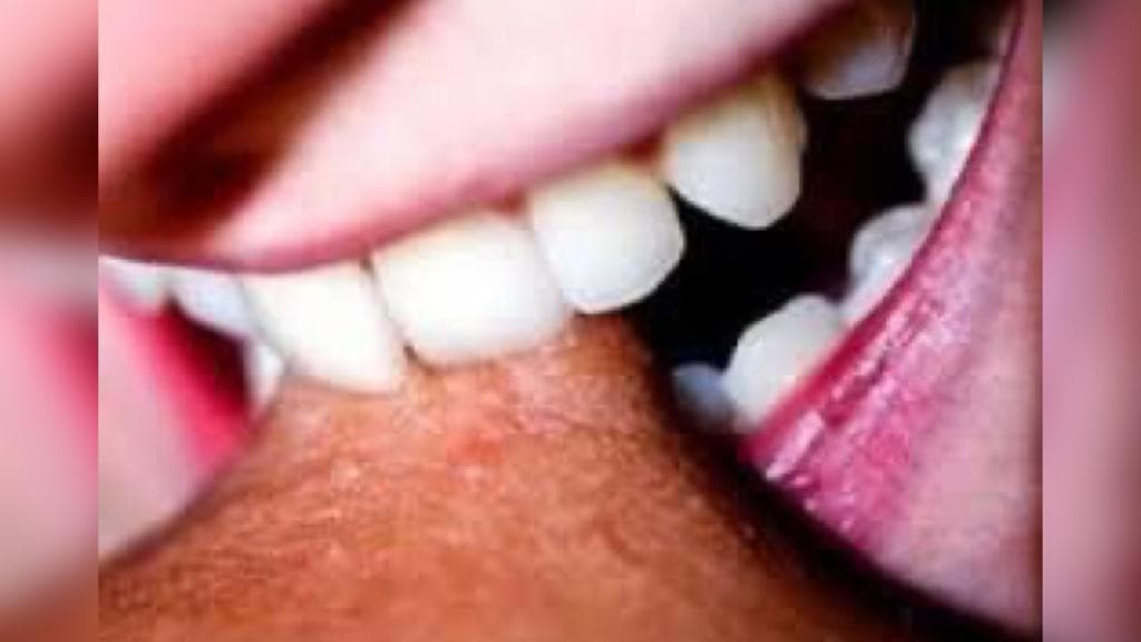 Esposa tenta pagar fiança após marido ciumento a morder e ser preso