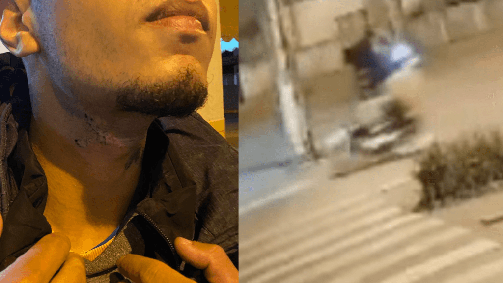 Jovem de Tijucas escapa da morte: “sorte que o fio arrebentou”