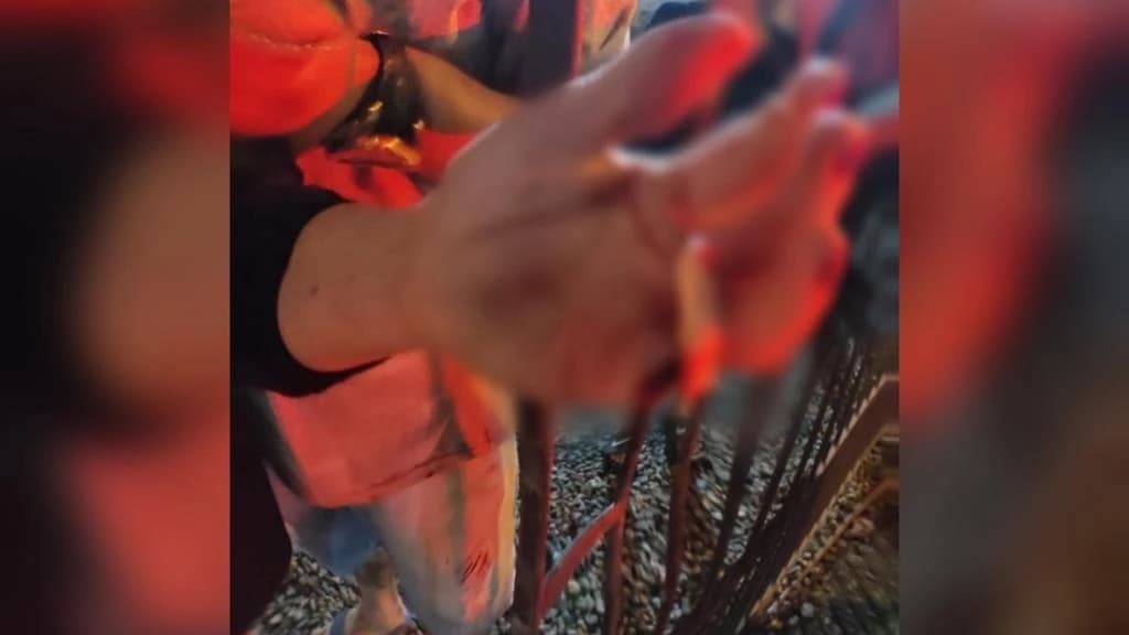 Mulher tem dedo amputado durante briga de vizinhos