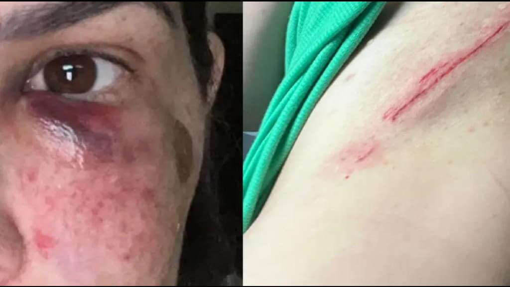 Mães brigam após desentendimento das filhas em escola de Brusque