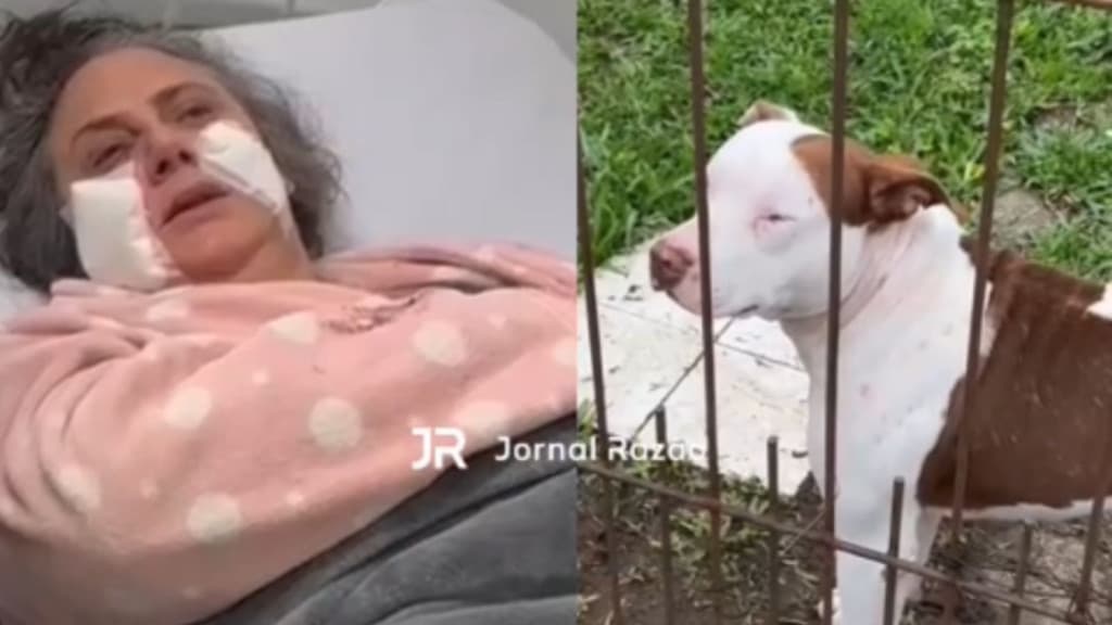 “O Duque é super dócil “: internada após ter sido mordida, idosa pede que cão não seja sacrificado