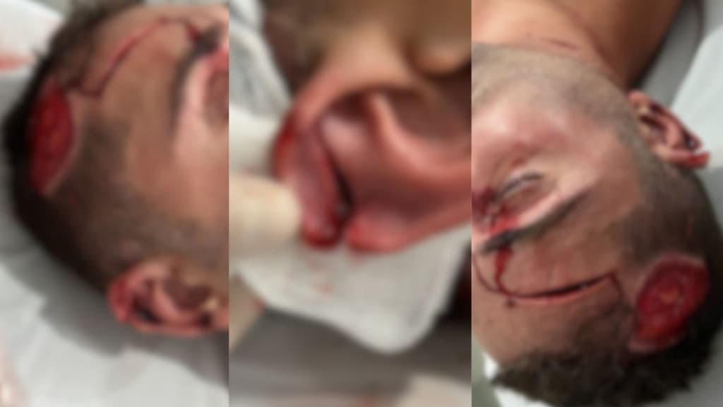 ATENÇÃO: Bandidos estão atacando moradores do Vale do Rio Tijucas