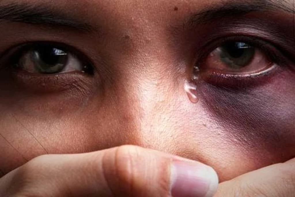Mulher espancada por marido vai parar no hospital de São João Batista