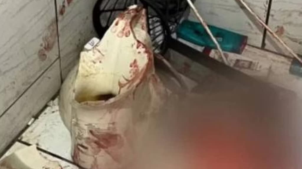 Mulher está na UTI após vaso se quebrar enquanto ela estava sentada